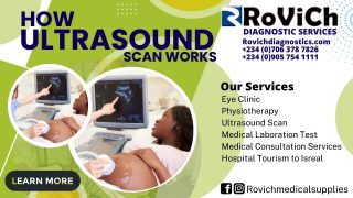 Importance of Ultrasound Scan Rovich